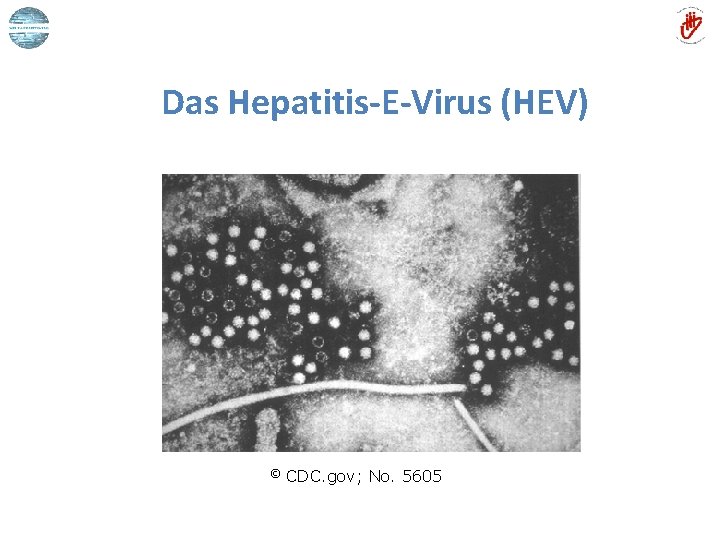 Das Hepatitis-E-Virus (HEV) © CDC. gov; No. 5605 