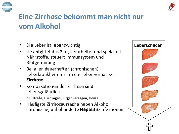 Eine Zirrhose bekommt man nicht nur vom Alkohol • Die Leber ist lebenswichtig •