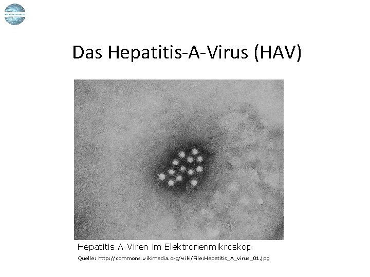 Das Hepatitis-A-Virus (HAV) Hepatitis-A-Viren im Elektronenmikroskop Quelle: http: //commons. wikimedia. org/wiki/File: Hepatitis_A_virus_01. jpg 