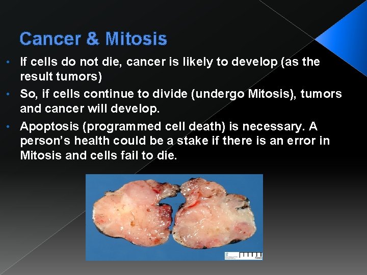 Cancer & Mitosis If cells do not die, cancer is likely to develop (as
