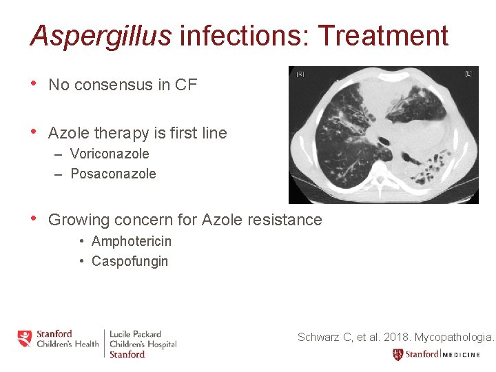 Aspergillus infections: Treatment • No consensus in CF • Azole therapy is first line