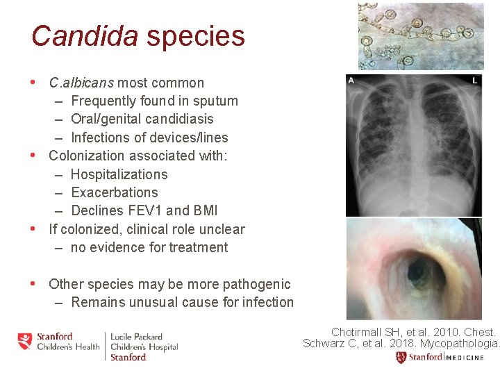 Candida species • C. albicans most common – Frequently found in sputum – Oral/genital