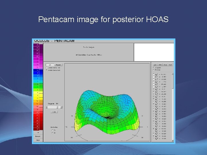 Pentacam image for posterior HOAS 