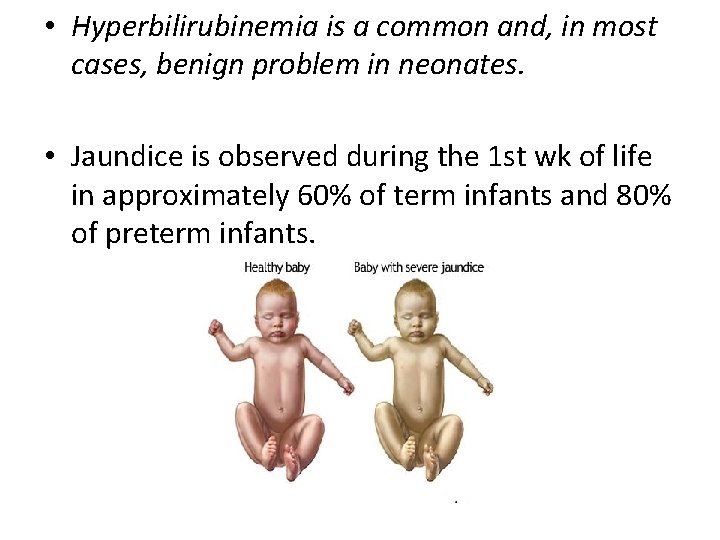  • Hyperbilirubinemia is a common and, in most cases, benign problem in neonates.