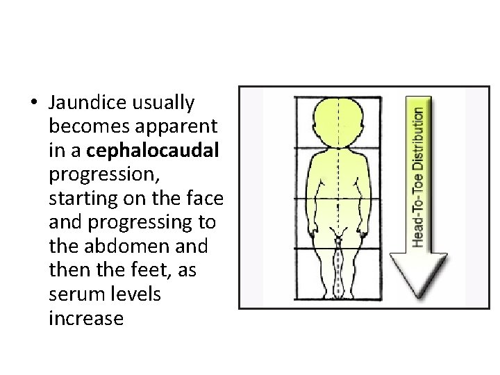  • Jaundice usually becomes apparent in a cephalocaudal progression, starting on the face