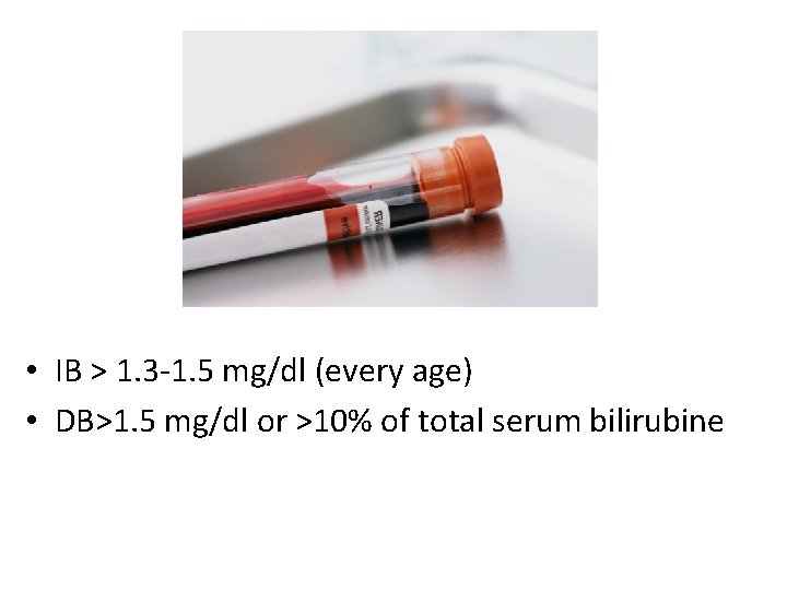  • IB > 1. 3 -1. 5 mg/dl (every age) • DB>1. 5