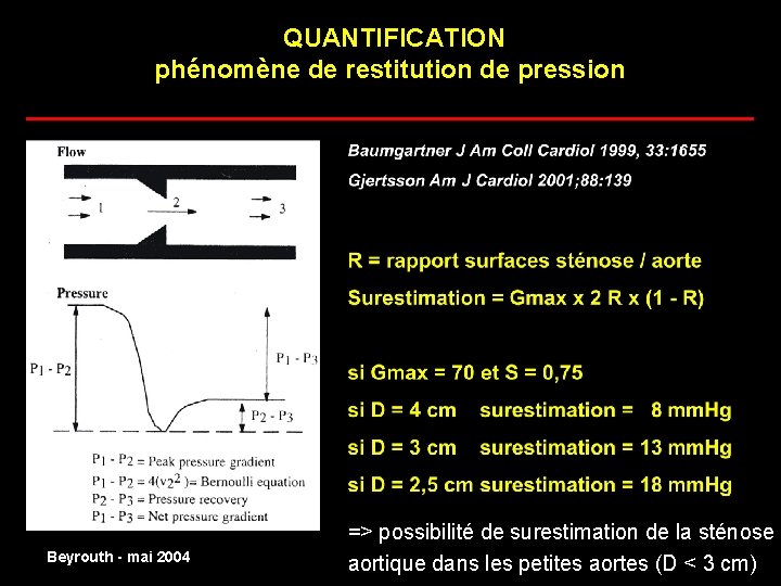 QUANTIFICATION phénomène de restitution de pression ______________________ normal Beyrouth - mai 2004 => possibilité