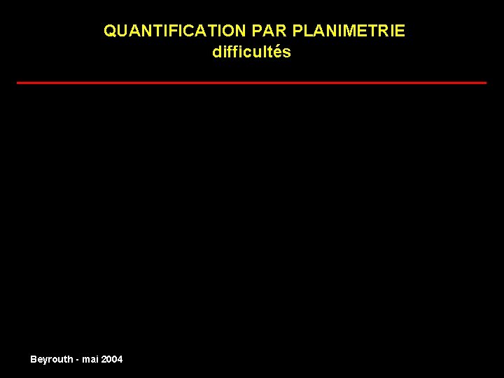 QUANTIFICATION PAR PLANIMETRIE difficultés ______________________ I 1 I 2 normal Beyrouth - mai 2004