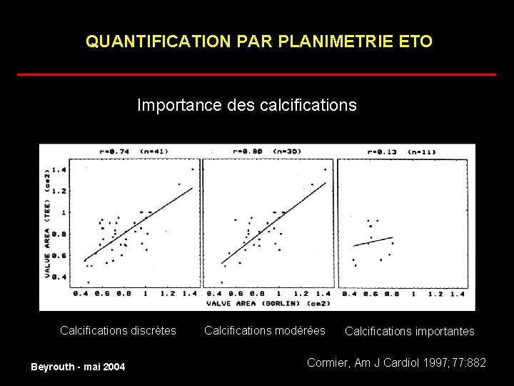 QUANTIFICATION PAR PLANIMETRIE ETO ______________________ Importance des calcifications normal Calcifications discrètes Beyrouth - mai