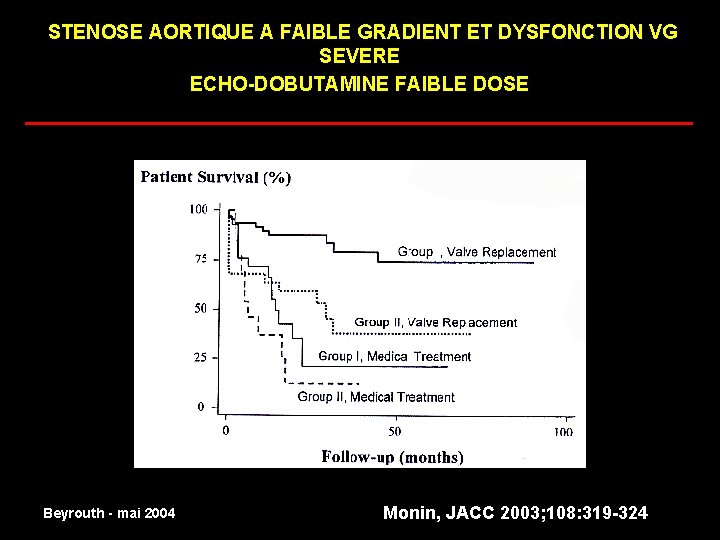 STENOSE AORTIQUE A FAIBLE GRADIENT ET DYSFONCTION VG SEVERE ECHO-DOBUTAMINE FAIBLE DOSE _________________________ normal