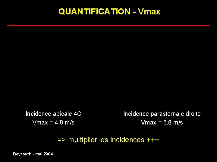 QUANTIFICATION - Vmax ______________________ Incidence apicale 4 C normal Vmax = 4. 8 m/s
