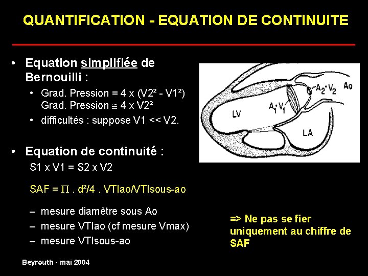 QUANTIFICATION - EQUATION DE CONTINUITE ______________________ • Equation simplifiée de Bernouilli : • Grad.