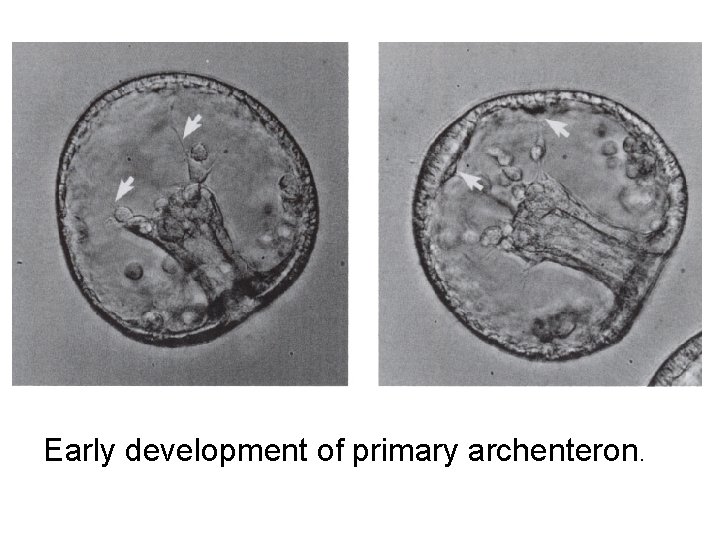 Early development of primary archenteron. 
