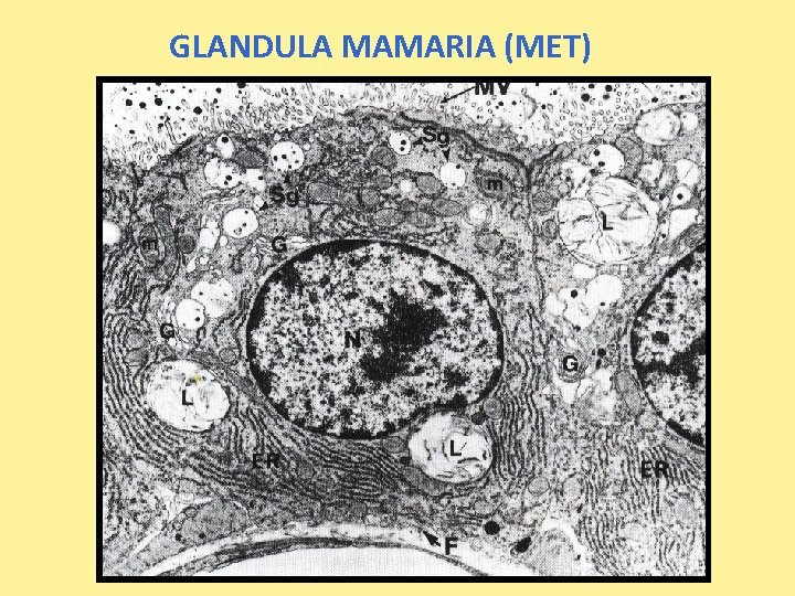 GLANDULA MAMARIA (MET) 