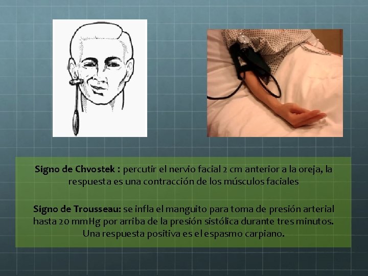 Signo de Chvostek : percutir el nervio facial 2 cm anterior a la oreja,