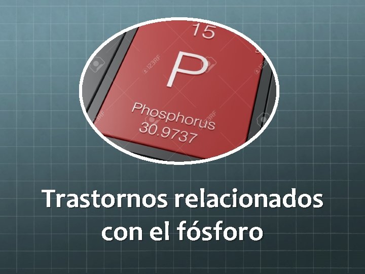 Trastornos relacionados con el fósforo 