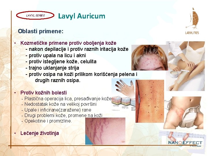 LAVYL SERIES Lavyl Auricum Oblasti primene: • Kozmetičke primene protiv oboljenja kože - nakon