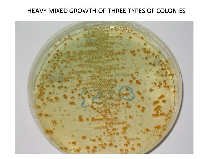 HEAVY MIXED GROWTH OF THREE TYPES OF COLONIES 