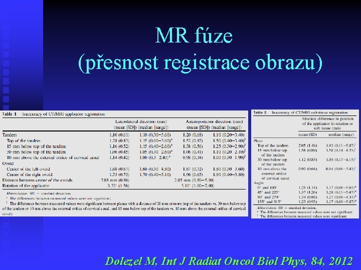 MR fúze (přesnost registrace obrazu) Dolezel M, Int J Radiat Oncol Biol Phys, 84,