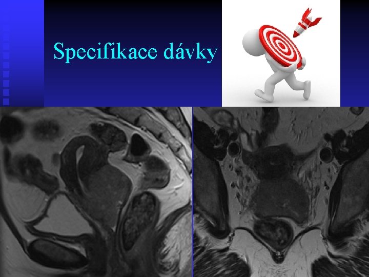 Specifikace dávky 