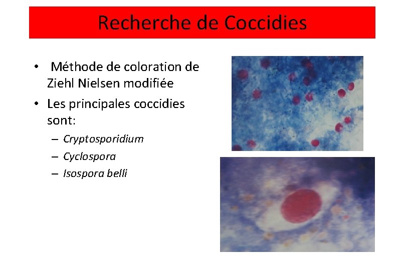 Recherche de Coccidies • Méthode de coloration de Ziehl Nielsen modifiée • Les principales