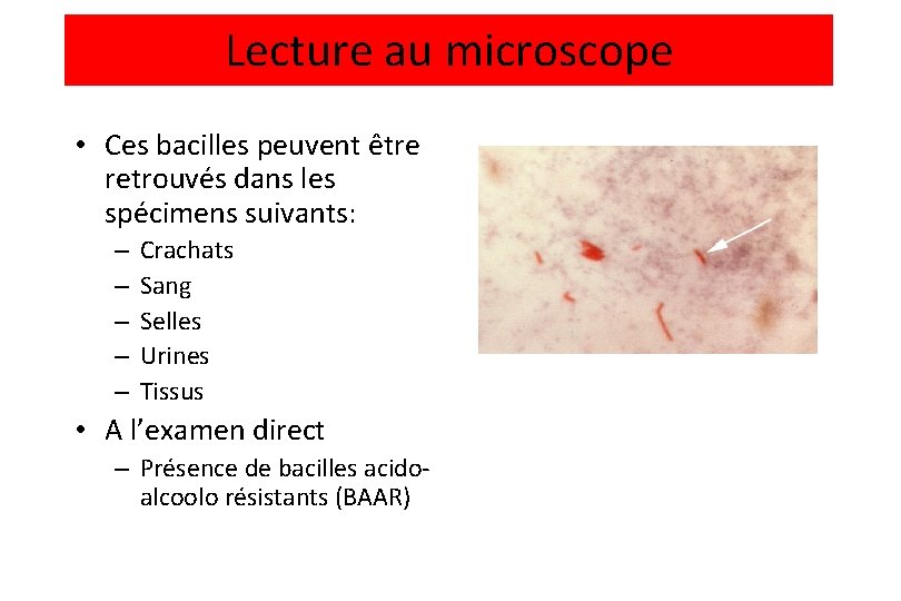 Lecture au microscope • Ces bacilles peuvent être retrouvés dans les spécimens suivants: –