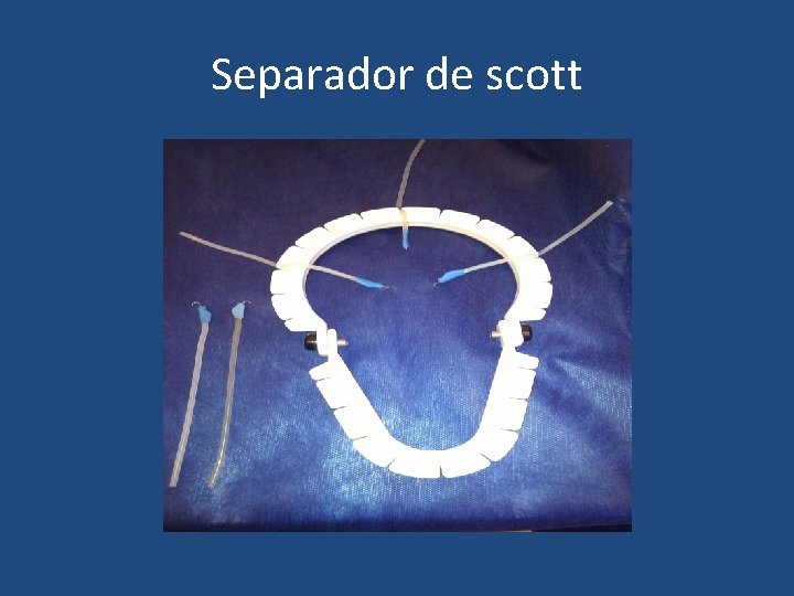 Separador de scott 