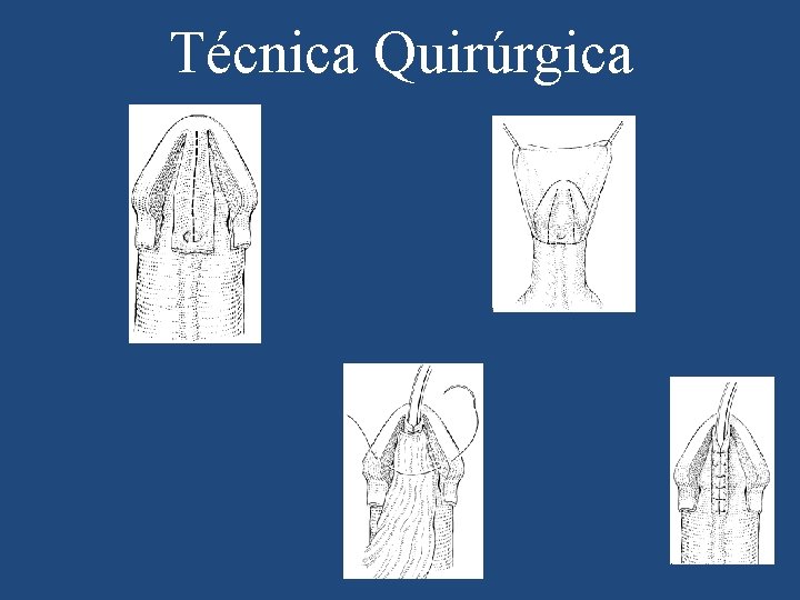 Técnica Quirúrgica 