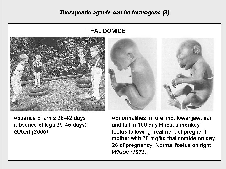 Therapeutic agents can be teratogens (3) THALIDOMIDE Absence of arms 38 -42 days (absence