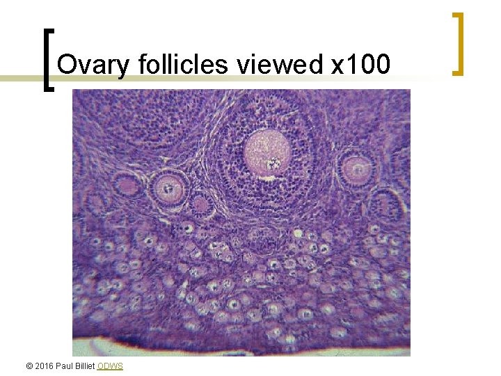 Ovary follicles viewed x 100 © 2016 Paul Billiet ODWS 