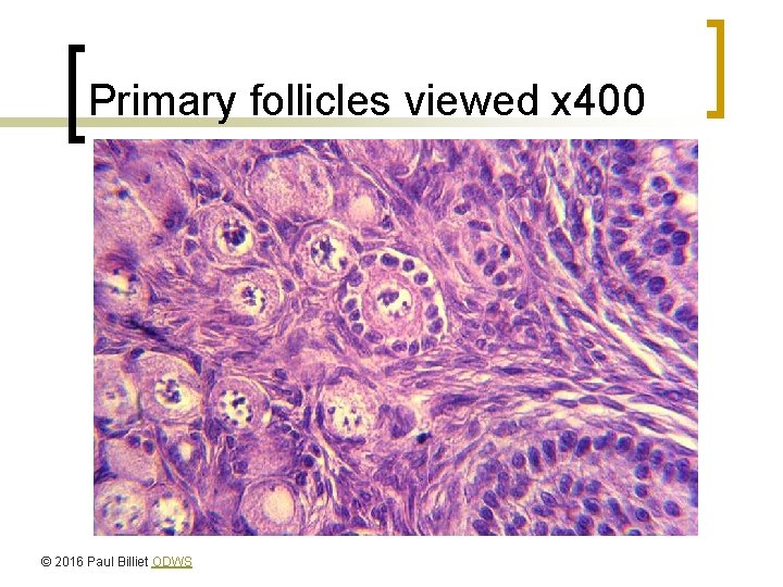 Primary follicles viewed x 400 © 2016 Paul Billiet ODWS 