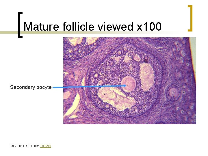 Mature follicle viewed x 100 Secondary oocyte © 2016 Paul Billiet ODWS 