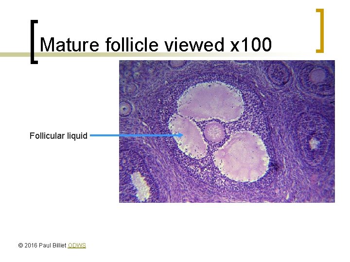 Mature follicle viewed x 100 Follicular liquid © 2016 Paul Billiet ODWS 