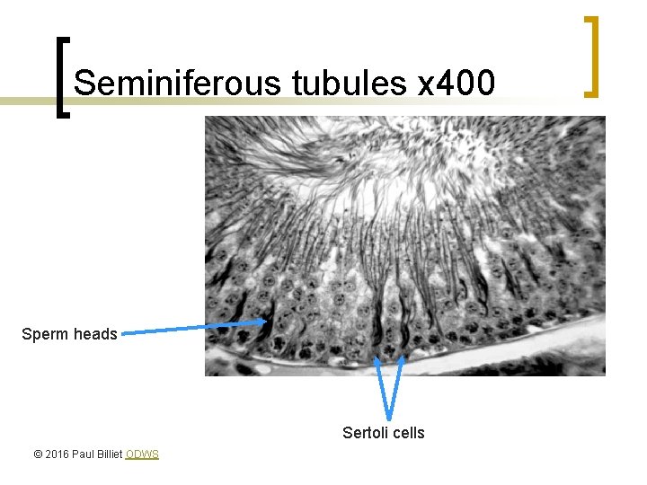 Seminiferous tubules x 400 Sperm heads Sertoli cells © 2016 Paul Billiet ODWS 