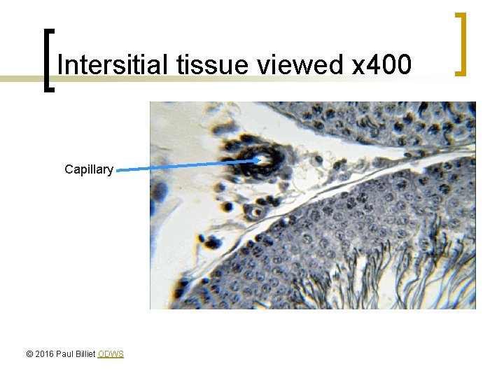 Intersitial tissue viewed x 400 Capillary © 2016 Paul Billiet ODWS 