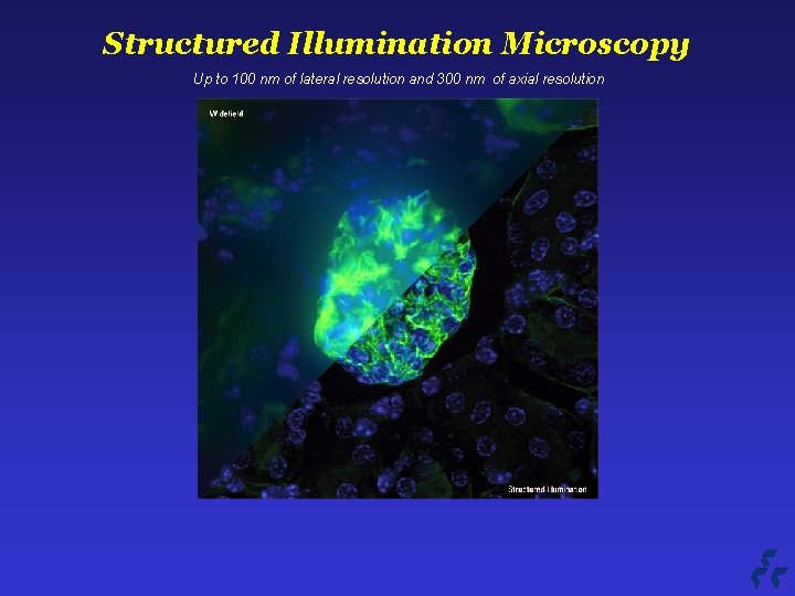 Structured Illumination Microscopy Up to 100 nm of lateral resolution and 300 nm of