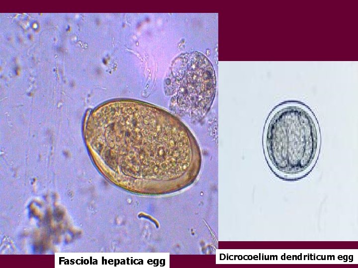 Fasciola hepatica egg Dicrocoelium dendriticum egg 