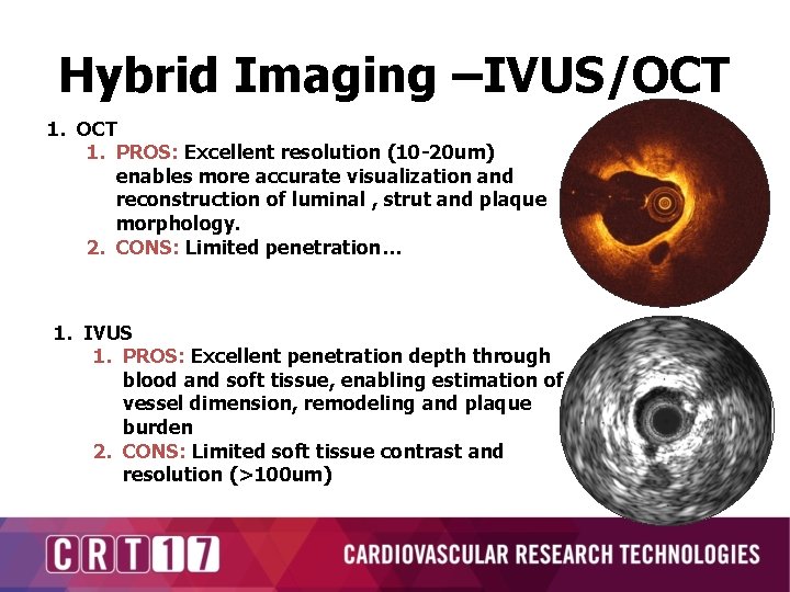 Hybrid Imaging –IVUS/OCT 1. PROS: Excellent resolution (10 -20 um) enables more accurate visualization