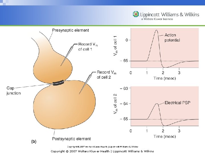 Copyright © 2007 Wolters Kluwer Health | Lippincott Williams & Wilkins 