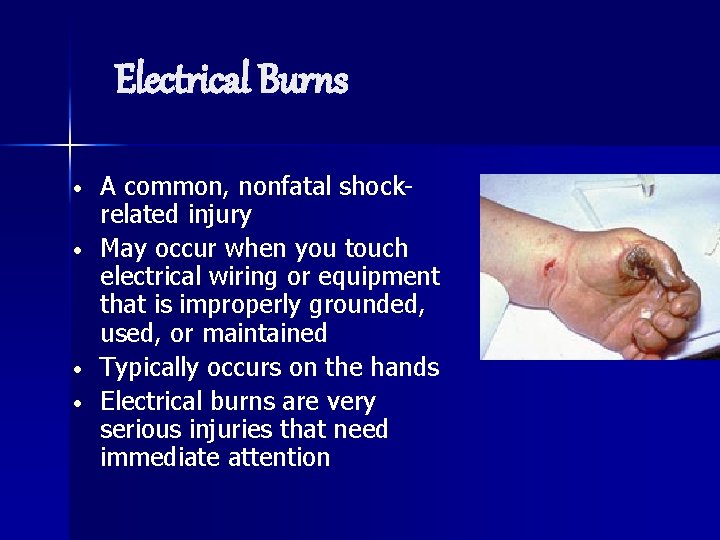 Electrical Burns • • A common, nonfatal shockrelated injury May occur when you touch