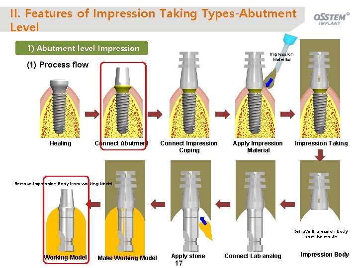 II. Features of Impression Taking Types-Abutment Level 1) Abutment level Impression Materilal (1) Process