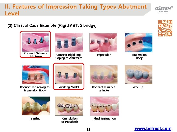 II. Features of Impression Taking Types-Abutment Level (2) Clinical Case Example (Rigid ABT. 3