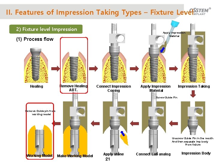 II. Features of Impression Taking Types – Fixture Level 2) Fixture level Impression Apply