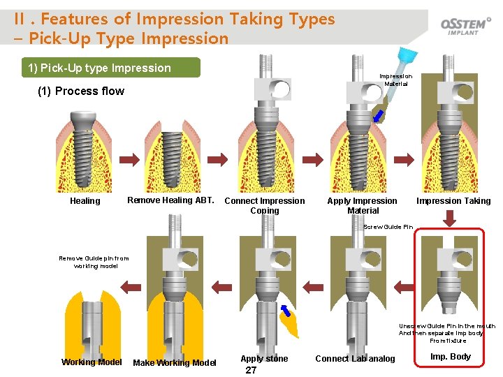 II. Features of Impression Taking Types – Pick-Up Type Impression 1) Pick-Up type Impression