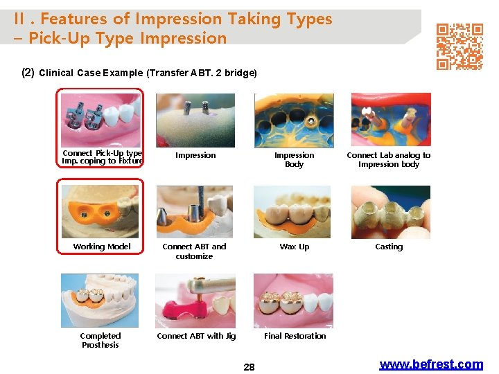 II. Features of Impression Taking Types – Pick-Up Type Impression (2) Clinical Case Example