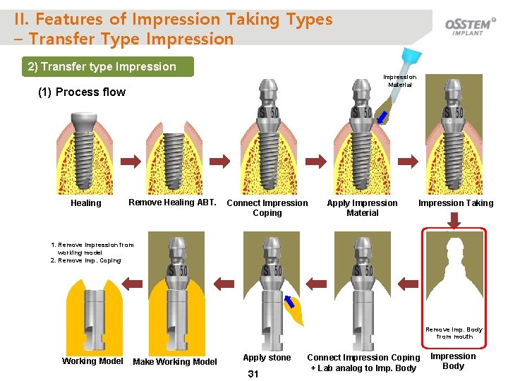 II. Features of Impression Taking Types – Transfer Type Impression 2) Transfer type Impression