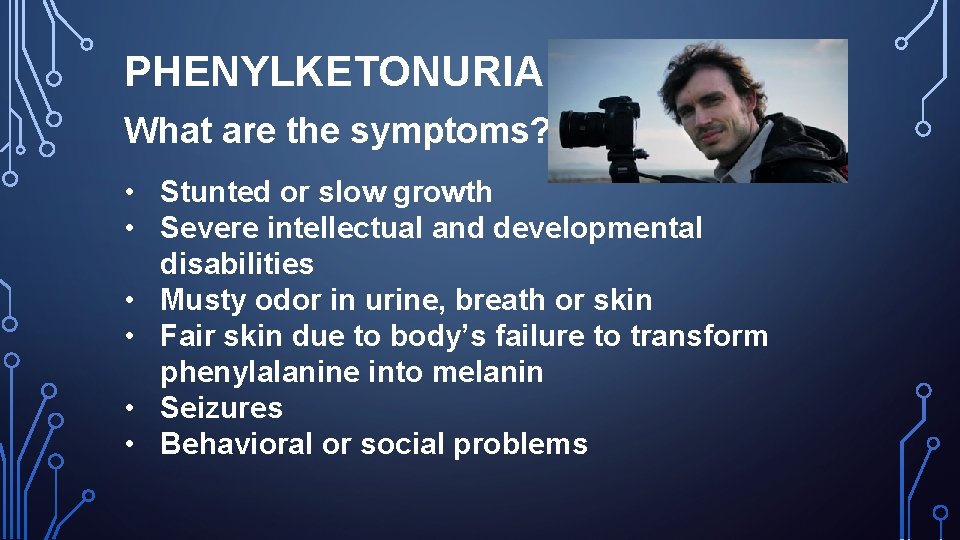 PHENYLKETONURIA What are the symptoms? • Stunted or slow growth • Severe intellectual and