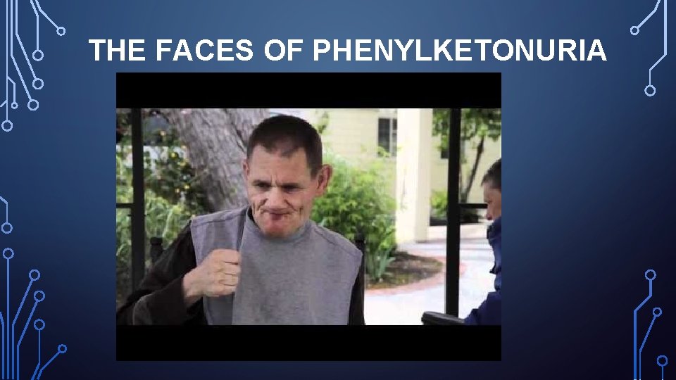 THE FACES OF PHENYLKETONURIA 