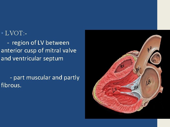  • LVOT: - region of LV between anterior cusp of mitral valve and