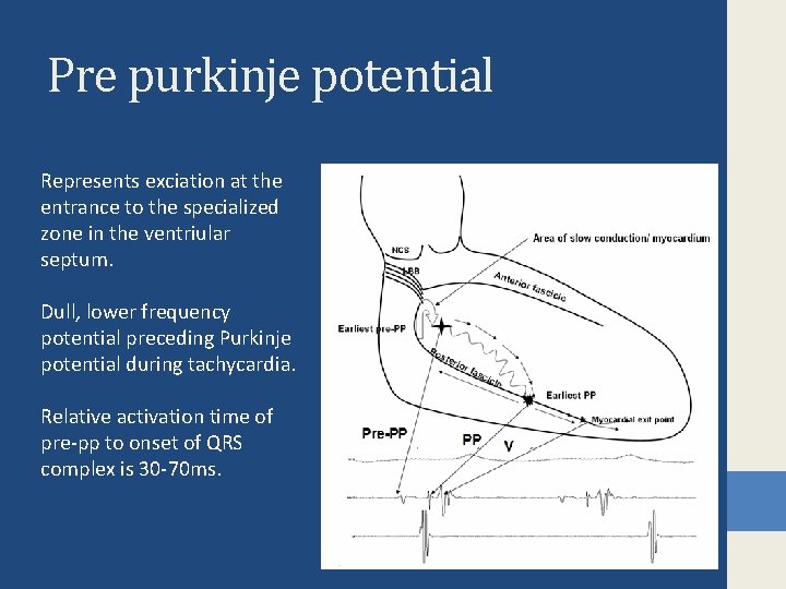 Pre purkinje potential Represents exciation at the entrance to the specialized zone in the